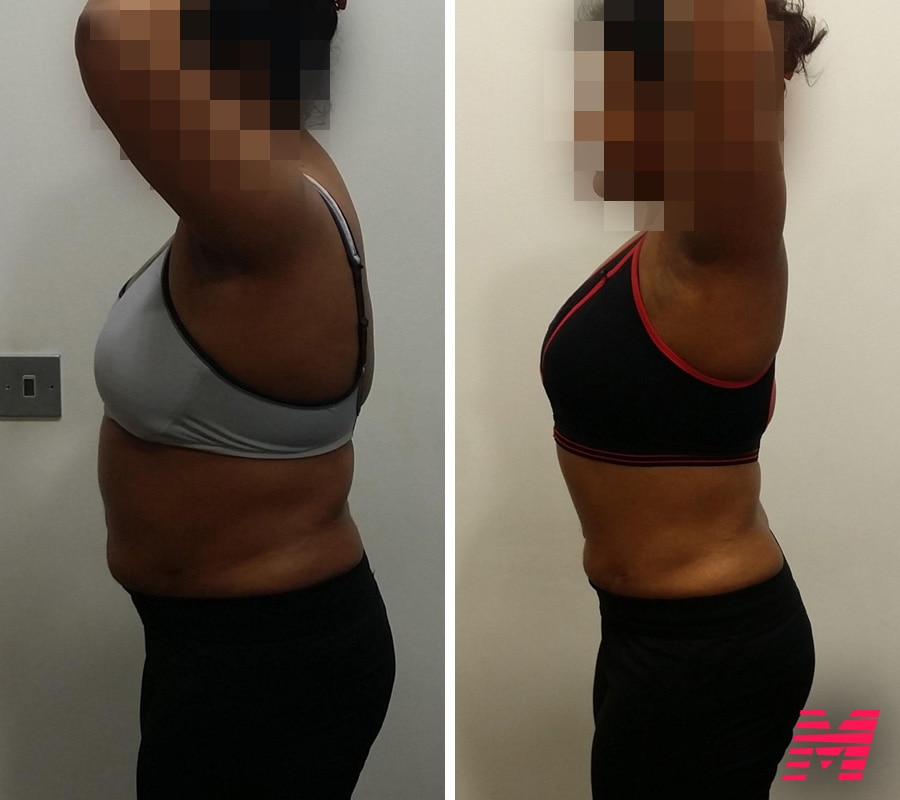 Before an after transformation results from a female personal training client in Toronto